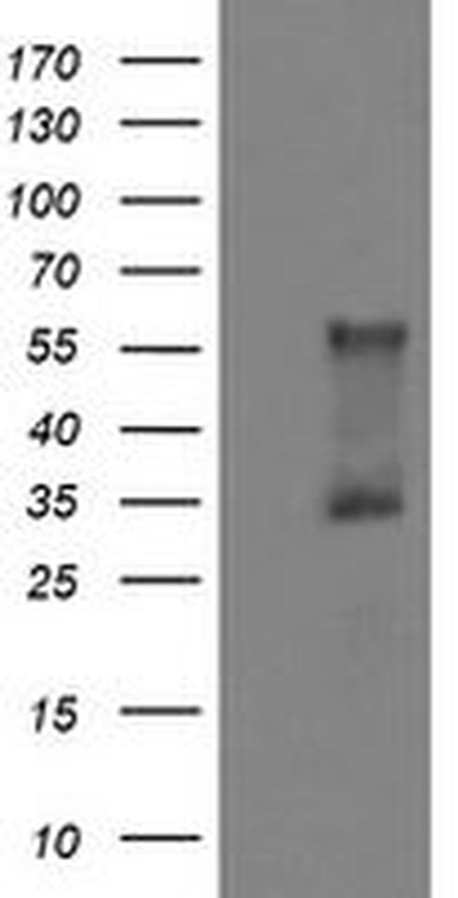 DOK7 Antibody in Western Blot (WB)