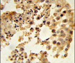 DPP8 Antibody in Immunohistochemistry (IHC)