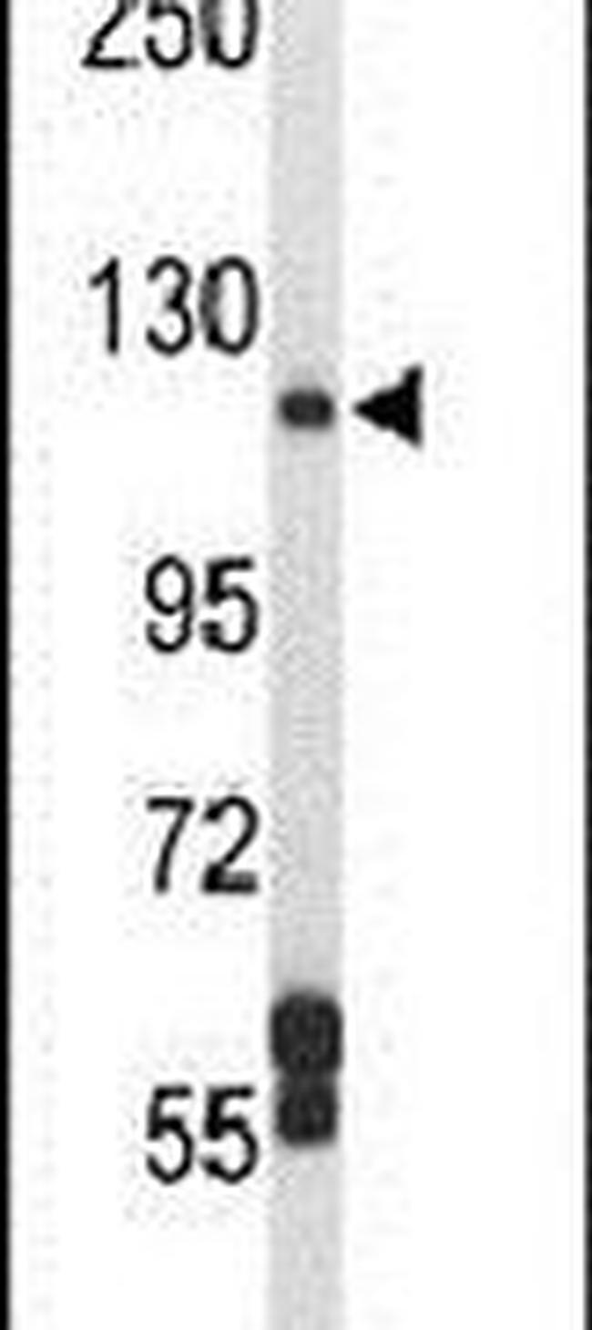 DPP8 Antibody in Western Blot (WB)