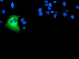 DPP9 Antibody in Immunocytochemistry (ICC/IF)