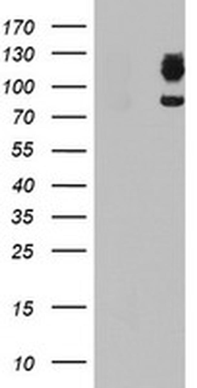 DPP9 Antibody in Western Blot (WB)