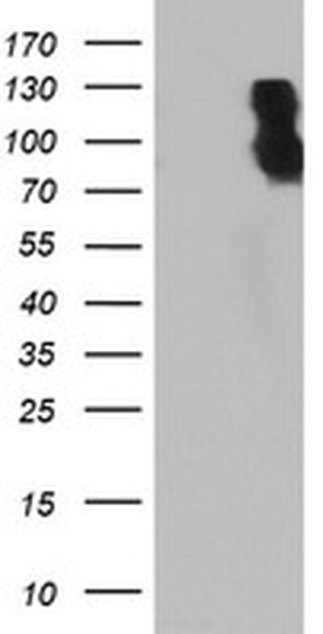 DPP9 Antibody in Western Blot (WB)