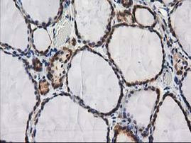 DSTN Antibody in Immunohistochemistry (Paraffin) (IHC (P))