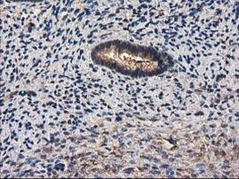 DSTN Antibody in Immunohistochemistry (Paraffin) (IHC (P))