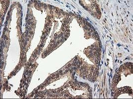 DSTN Antibody in Immunohistochemistry (Paraffin) (IHC (P))