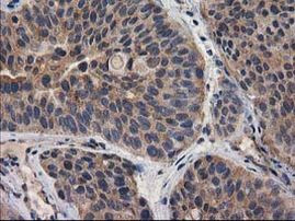 DSTN Antibody in Immunohistochemistry (Paraffin) (IHC (P))