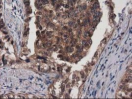 DSTN Antibody in Immunohistochemistry (Paraffin) (IHC (P))