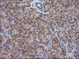 DSTN Antibody in Immunohistochemistry (Paraffin) (IHC (P))