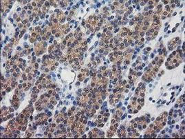 DSTN Antibody in Immunohistochemistry (Paraffin) (IHC (P))