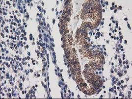 DSTN Antibody in Immunohistochemistry (Paraffin) (IHC (P))