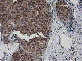 DSTN Antibody in Immunohistochemistry (Paraffin) (IHC (P))