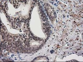 DSTN Antibody in Immunohistochemistry (Paraffin) (IHC (P))