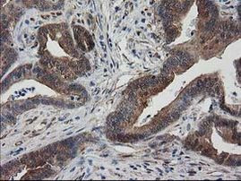 DSTN Antibody in Immunohistochemistry (Paraffin) (IHC (P))