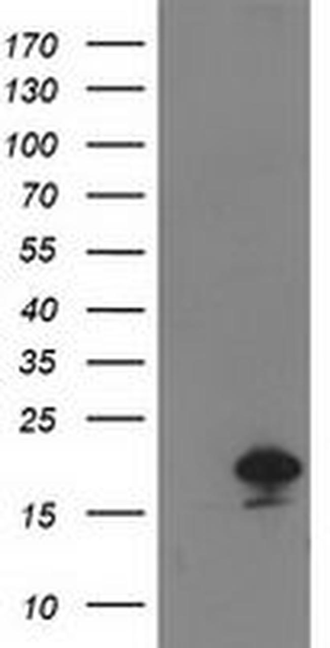 DSTN Antibody in Western Blot (WB)