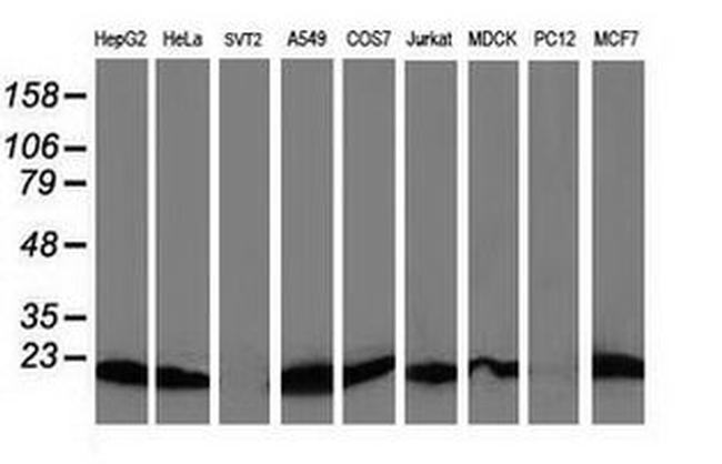 DSTN Antibody in Western Blot (WB)