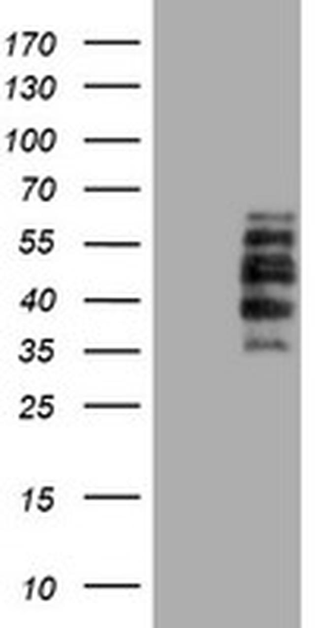 DTNB Antibody in Western Blot (WB)