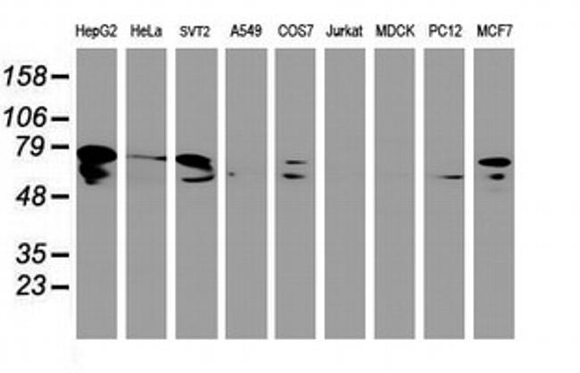 DTNB Antibody in Western Blot (WB)