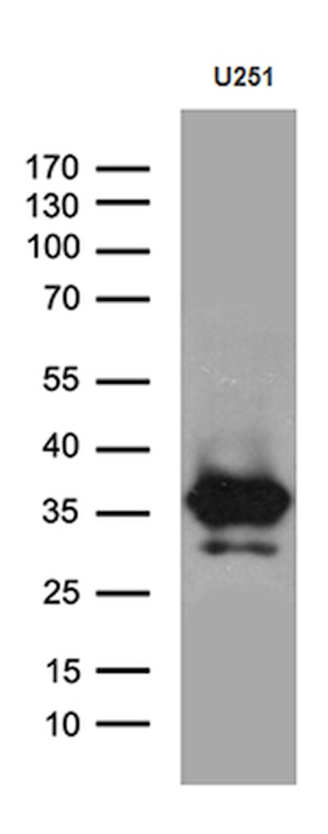 DTWD1 Antibody in Western Blot (WB)