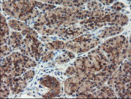 DUPD1 Antibody in Immunohistochemistry (Paraffin) (IHC (P))