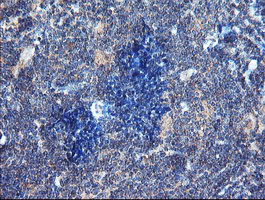 DUPD1 Antibody in Immunohistochemistry (Paraffin) (IHC (P))