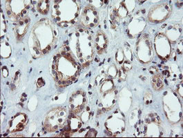 DUPD1 Antibody in Immunohistochemistry (Paraffin) (IHC (P))