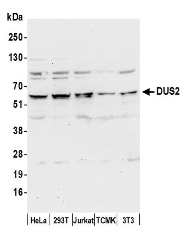 DUS2/DUS2L Antibody in Western Blot (WB)