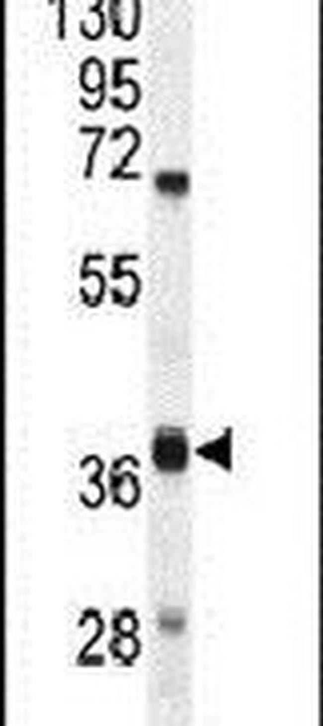 DUS4L Antibody in Western Blot (WB)