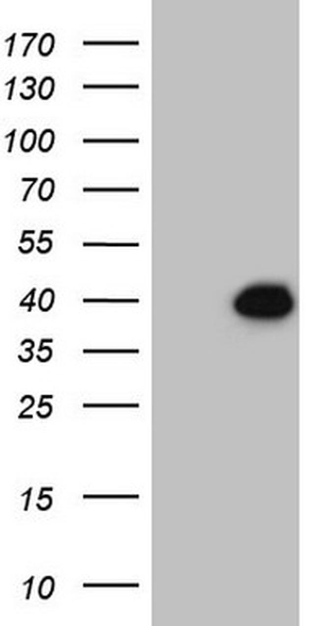 DUSP4 Antibody in Western Blot (WB)