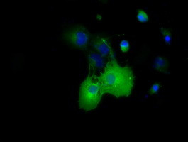 DYNC1LI1 Antibody in Immunocytochemistry (ICC/IF)