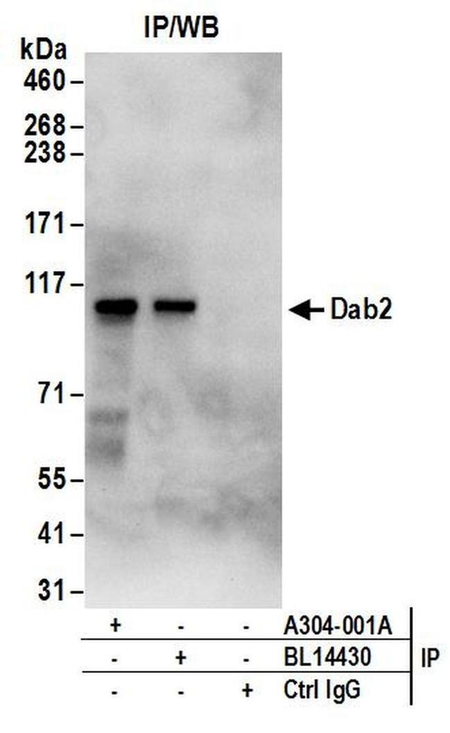 Dab2 Antibody in Western Blot (WB)