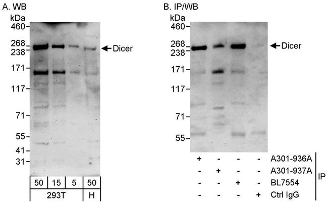 Dicer Antibody in Western Blot (WB)