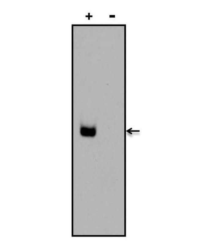 Digoxin Antibody in Western Blot (WB)