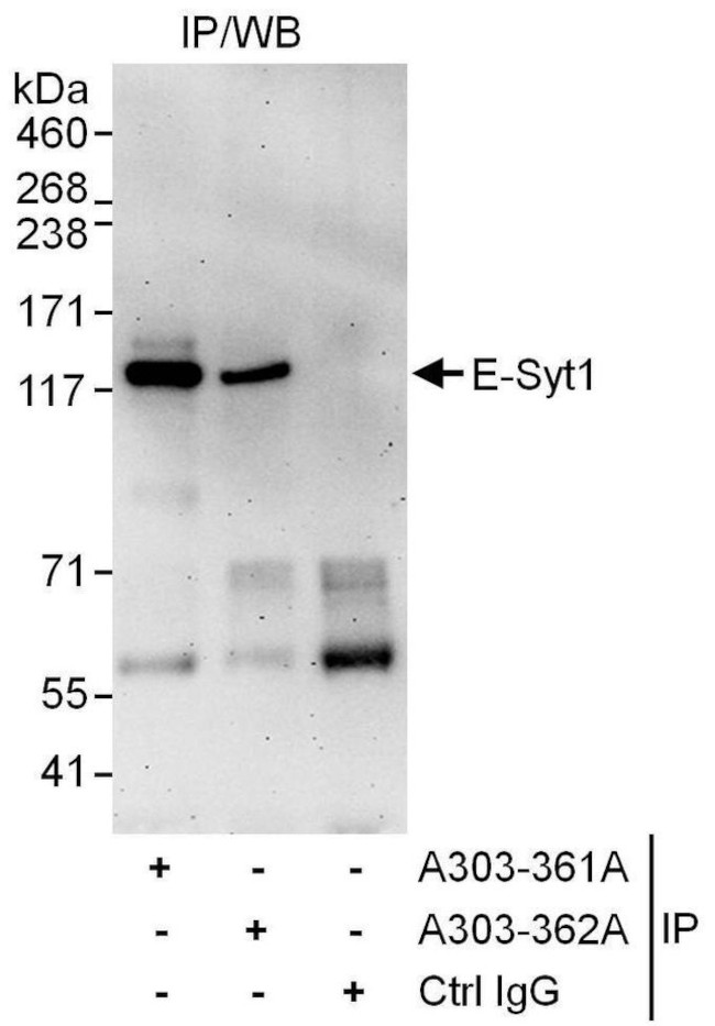 E-Syt1 Antibody in Immunoprecipitation (IP)