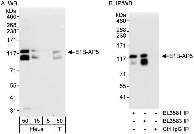 E1B-AP5 Antibody in Western Blot (WB)