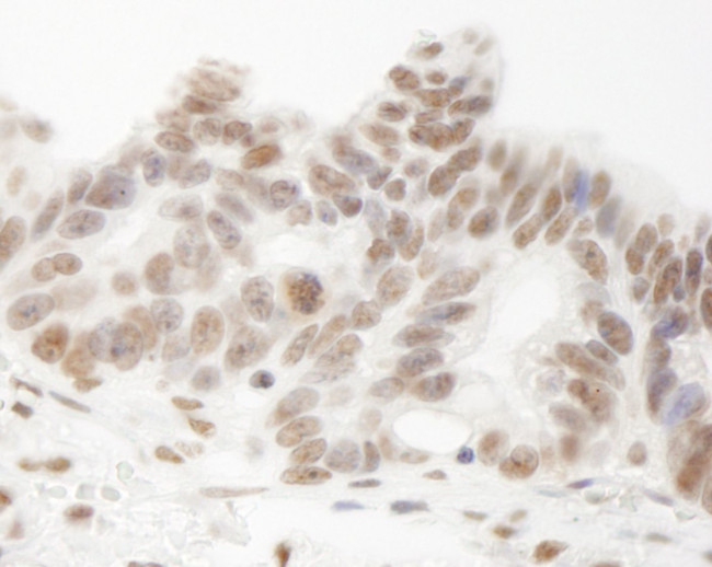 E1B-AP5 Antibody in Immunohistochemistry (IHC)