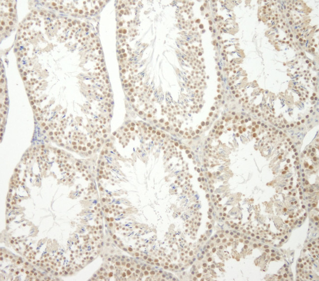 E1B-AP5 Antibody in Immunohistochemistry (IHC)