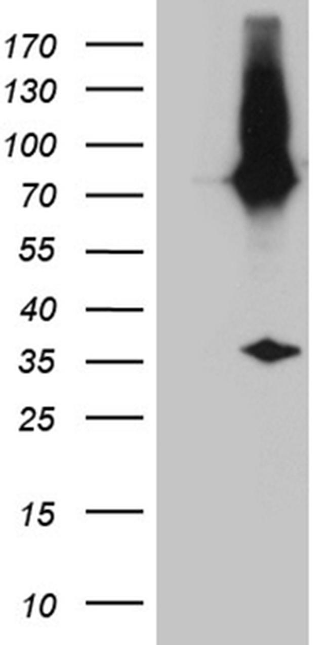 E2-Crimson Antibody in Western Blot (WB)