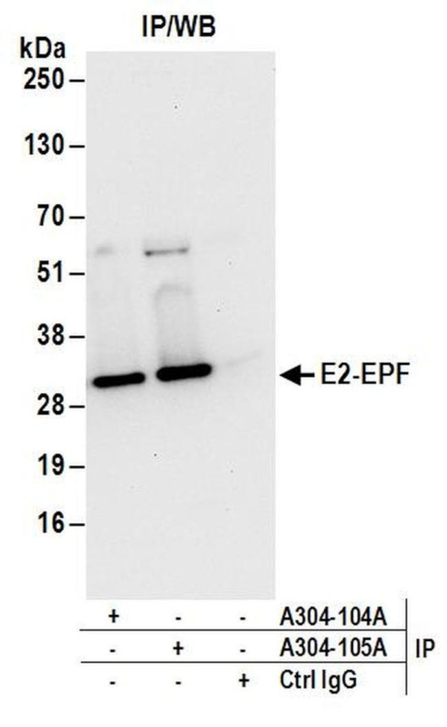 E2-EPF Antibody in Immunoprecipitation (IP)