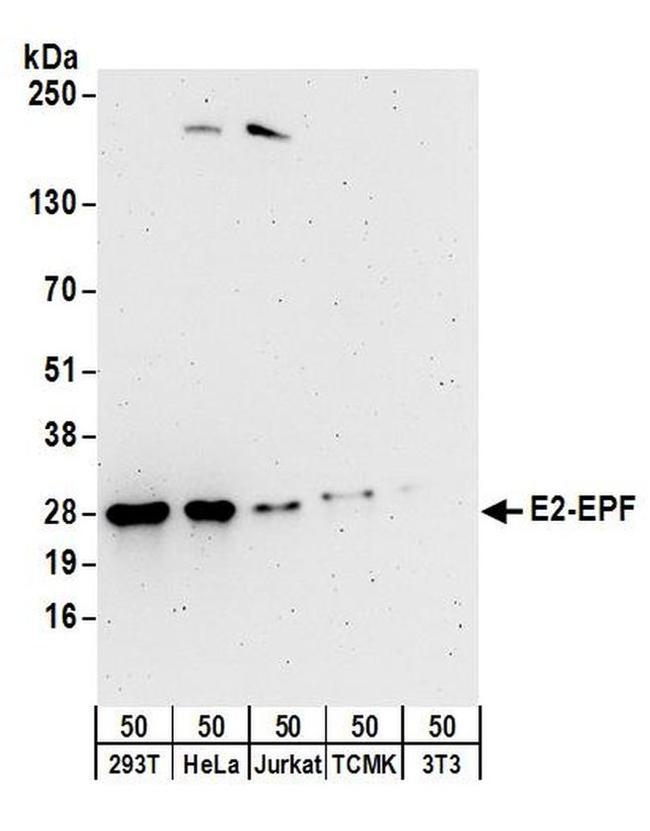 E2-EPF Antibody in Western Blot (WB)