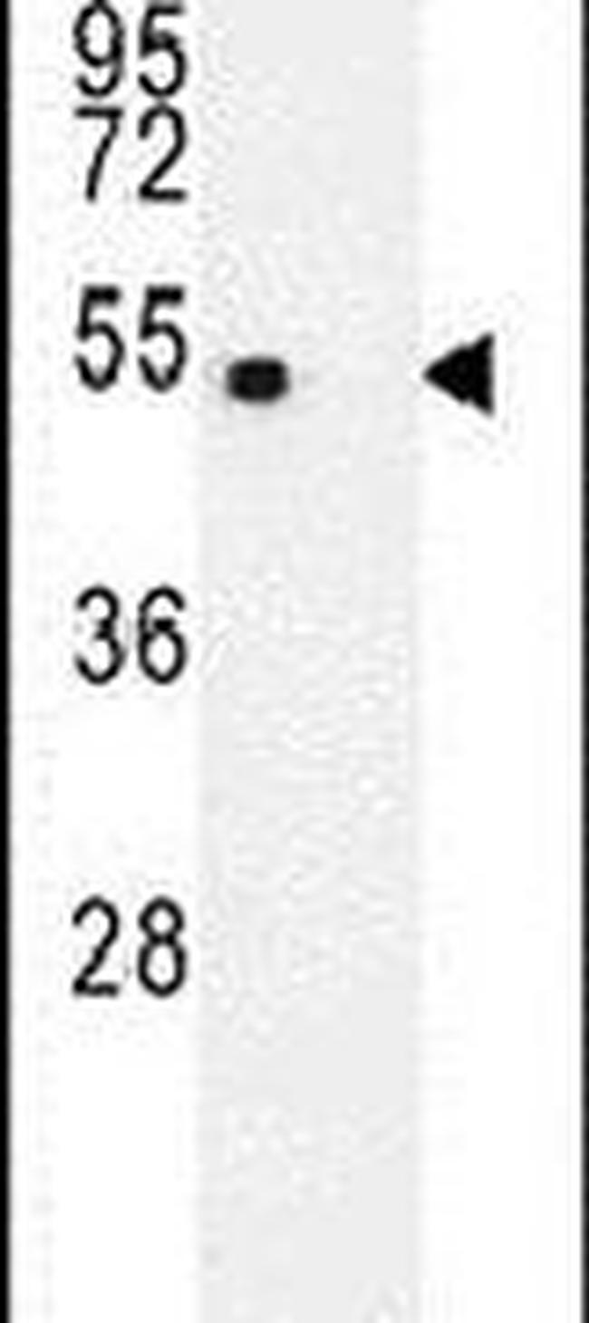 E2F1 Antibody in Western Blot (WB)