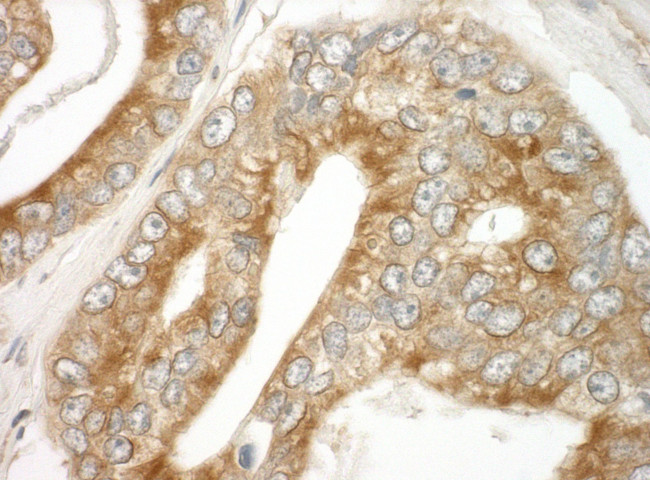 EB1 Antibody in Immunohistochemistry (IHC)