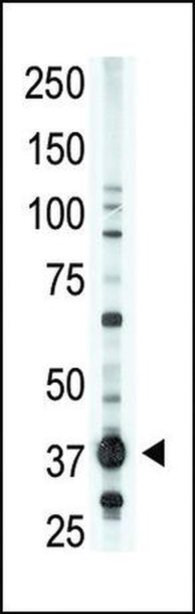 EDG2 Antibody in Western Blot (WB)