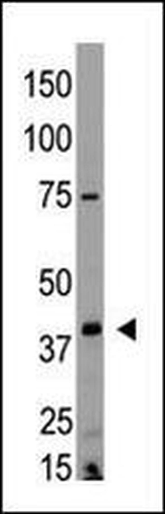 EDG4 Antibody in Western Blot (WB)