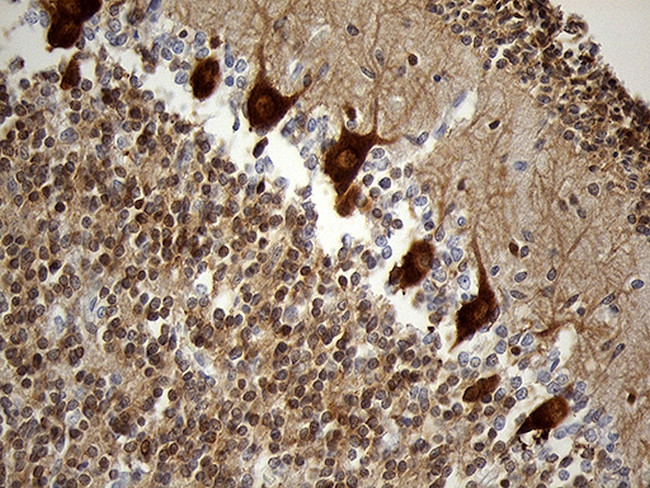 EEF1D Antibody in Immunohistochemistry (Paraffin) (IHC (P))