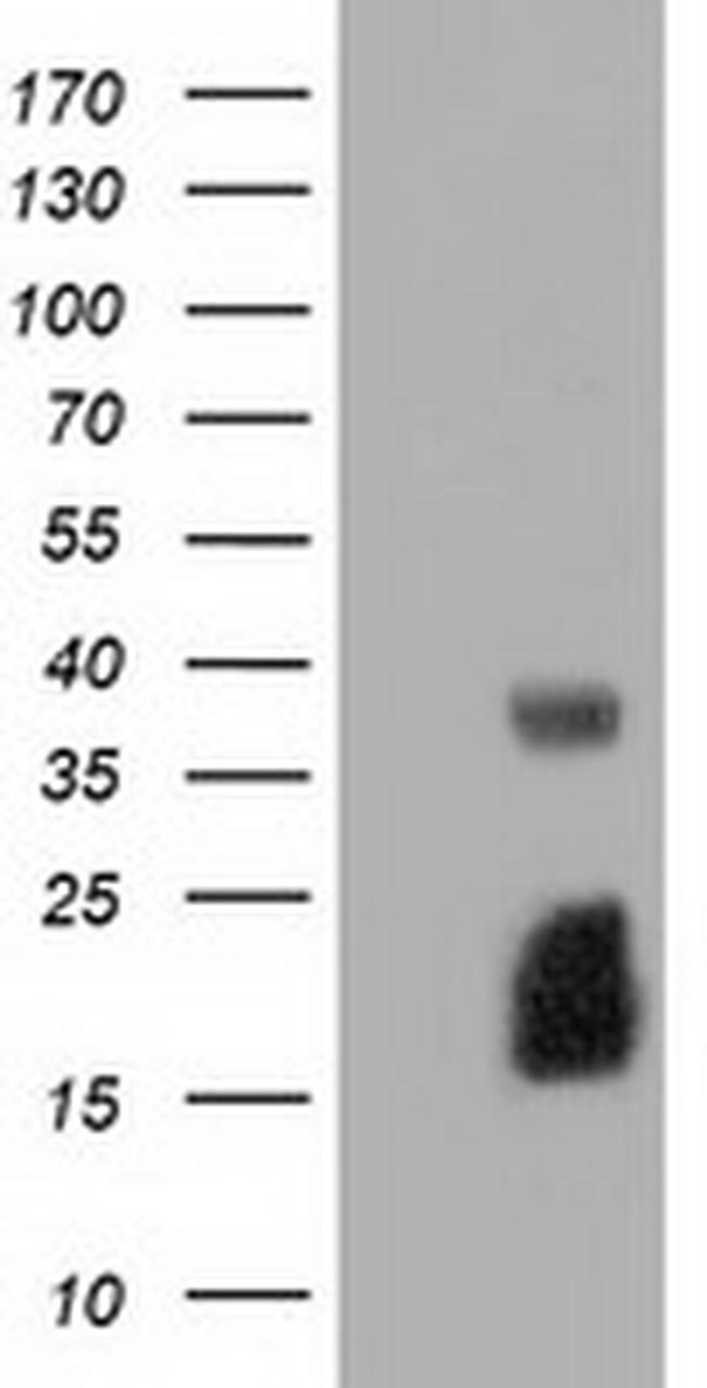 EFNA2 Antibody in Western Blot (WB)