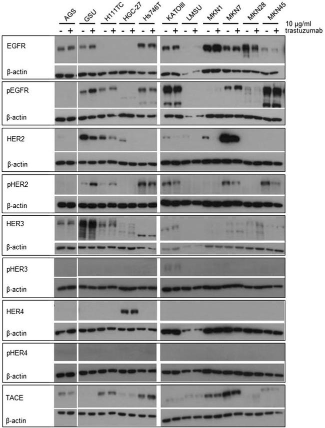 Phospho-EGFR (Tyr1068) Antibody in Western Blot (WB)