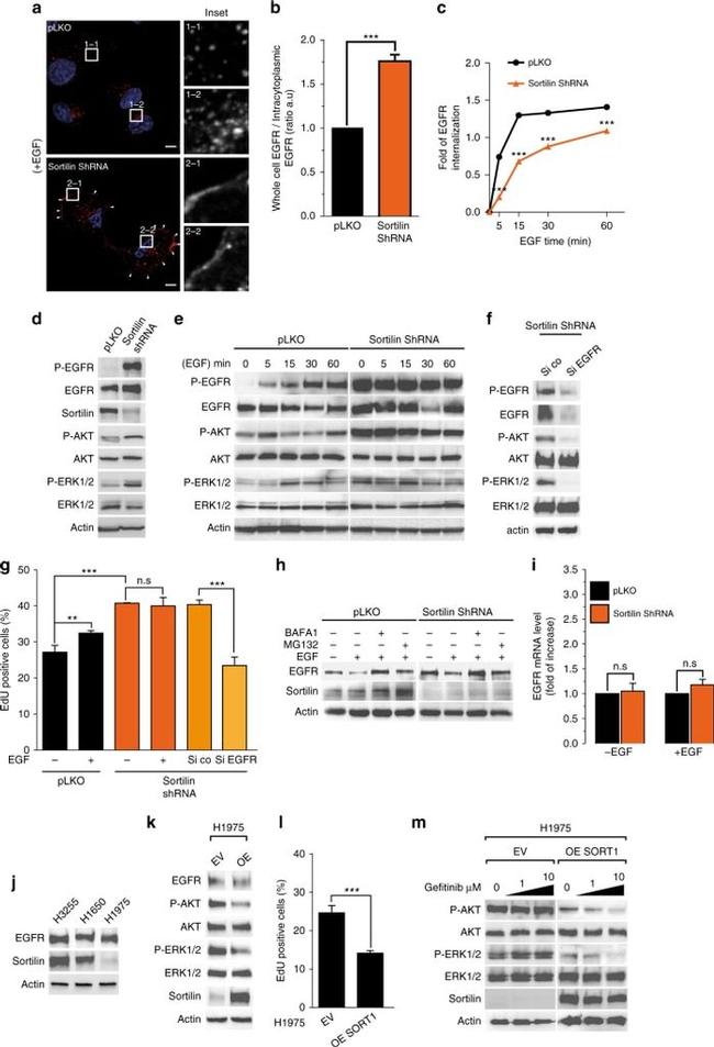 EGFR Antibody in Western Blot (WB)