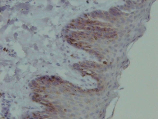 EGFR Antibody in Immunohistochemistry (Paraffin) (IHC (P))