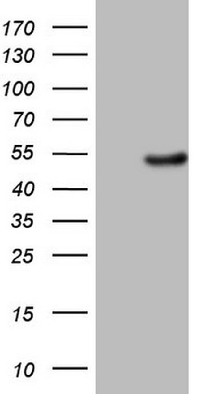 EGLN2 Antibody in Western Blot (WB)