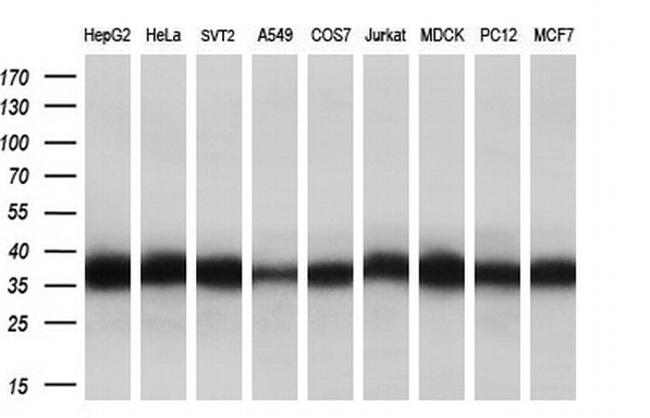 EIF2S1 Antibody in Western Blot (WB)